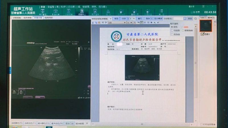 体检套餐：材质、参数、尺寸、型号揭秘